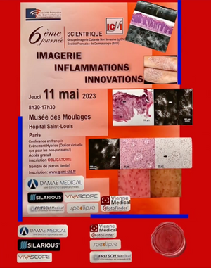 French Association of Dermatology (SFD), Saint LouisHospital