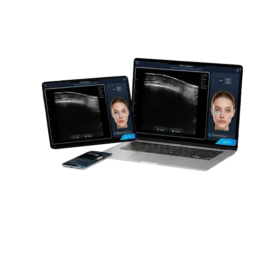 Ultrasound screen